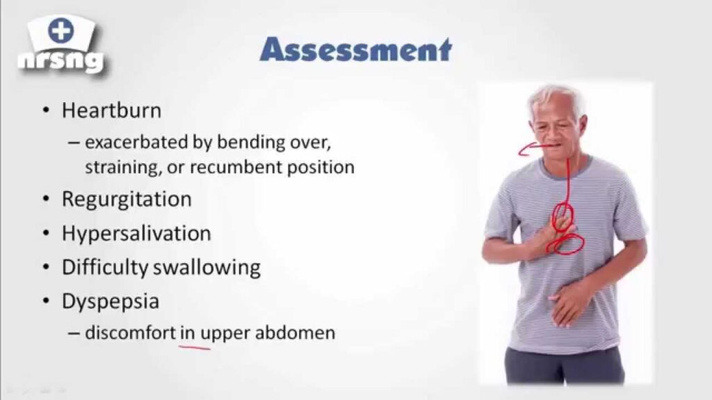 Key Nursing Considerations for GERD
