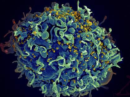 Latest Advances in HIV Infection Research