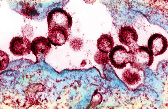 Latest Advances in HIV Infection Research