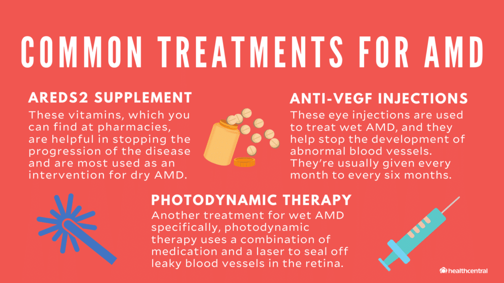Latest Treatments for Macular Degeneration