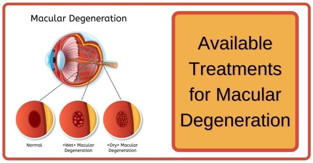 Latest Treatments for Macular Degeneration