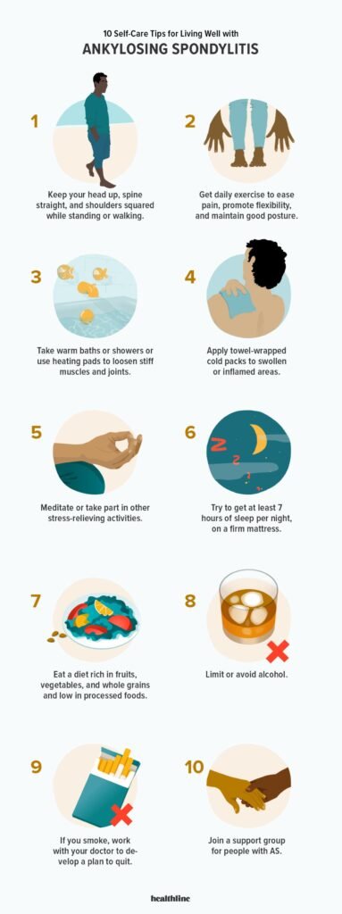 Living with Ankylosing Spondylitis: Tips for Daily Life and Quality of Life Improvement