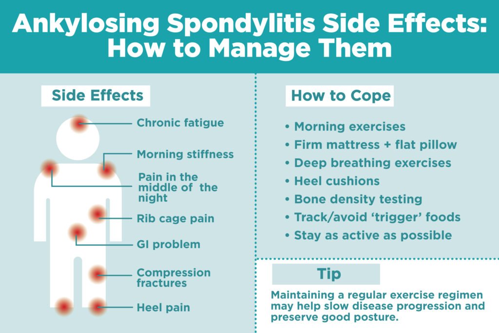 Living with Ankylosing Spondylitis: Tips for Daily Life and Quality of Life Improvement