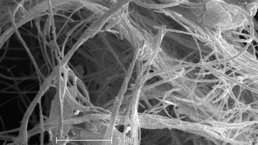 Living with Asbestosis: Managing the Symptoms and Enhancing Quality of Life