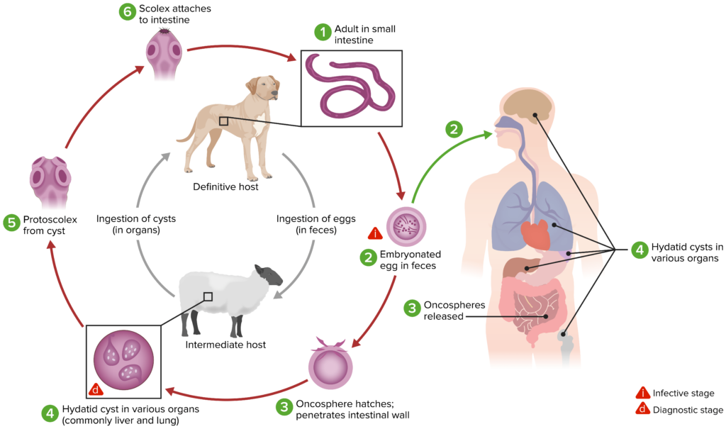 Living with Echinococcosis: Managing the Disease Effectively