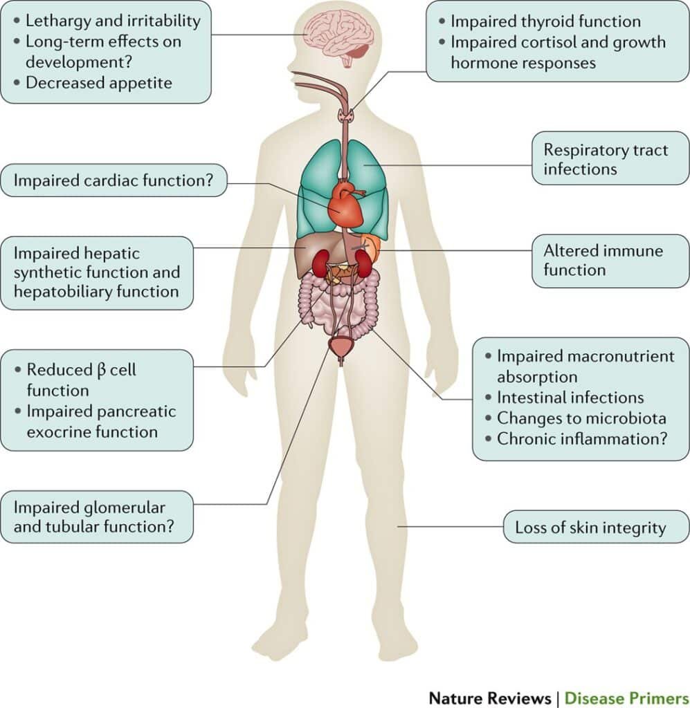 Malnutrition and its Relationship to Chronic Diseases