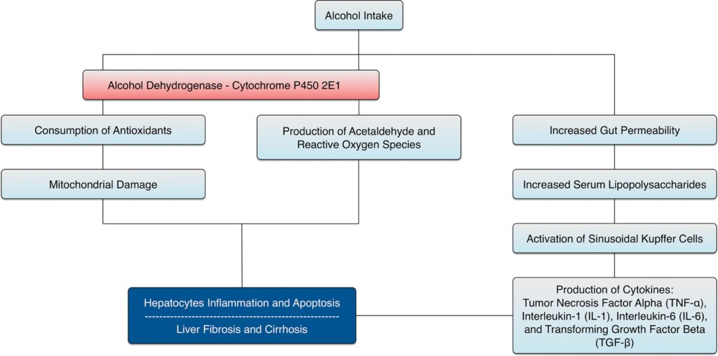 Managing Alcohol-related Liver Disease