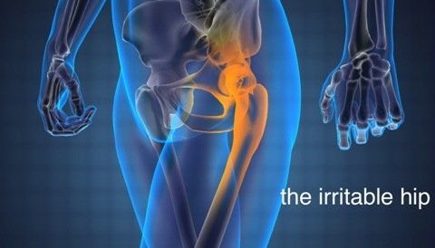 Managing and Treating Irritable Hip Syndrome in Adults