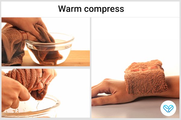 Managing Ganglion Cysts at Home: Natural Remedies and Prevention Tips