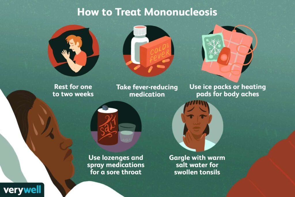Managing Glandular Fever: Coping Strategies and Recovery Tips