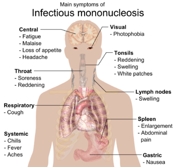 Managing Glandular Fever: Coping Strategies and Recovery Tips