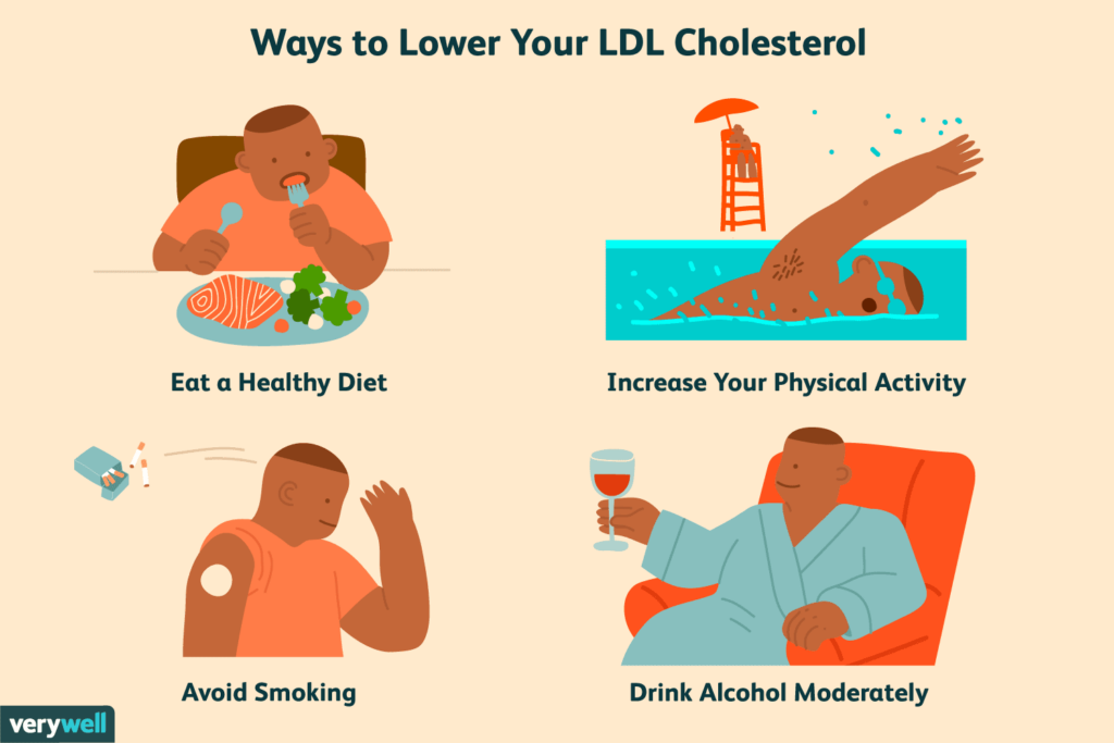 Managing High LDL Cholesterol Levels