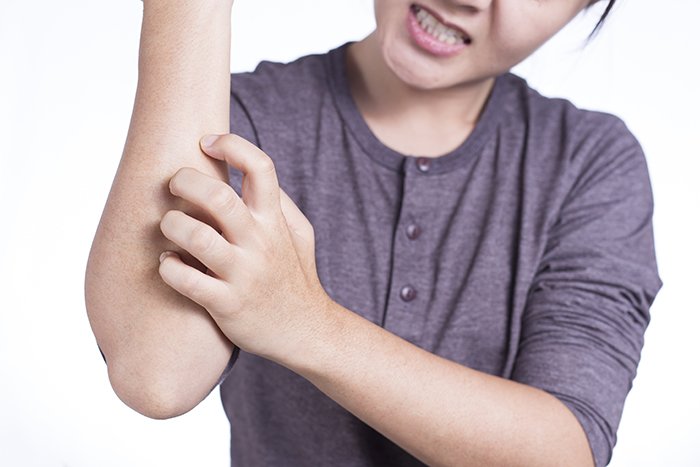 Managing Itching: Tips and Tricks