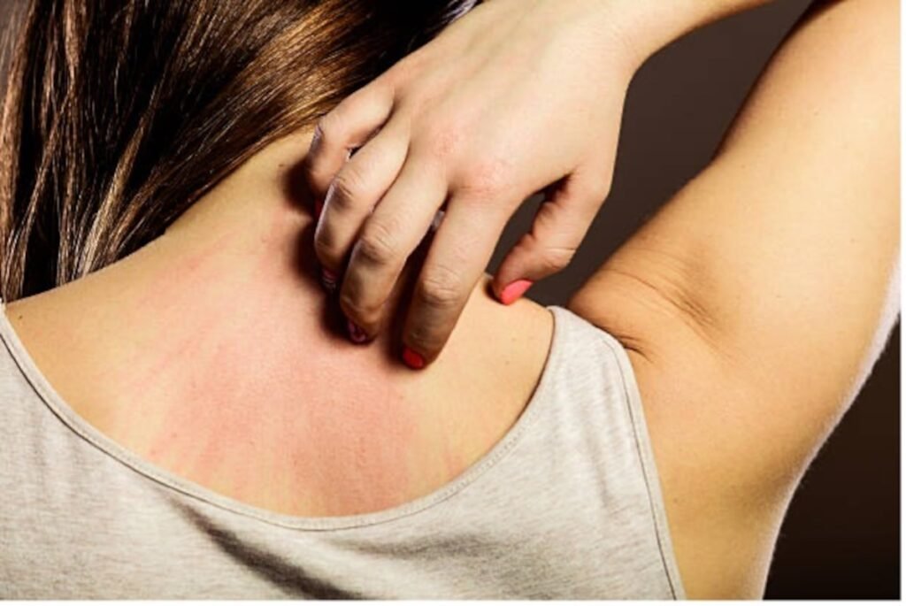Managing Itching: Tips and Tricks