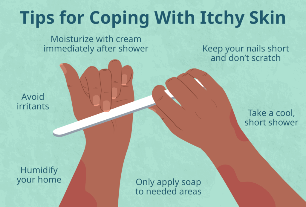 Managing Itching: Tips and Tricks