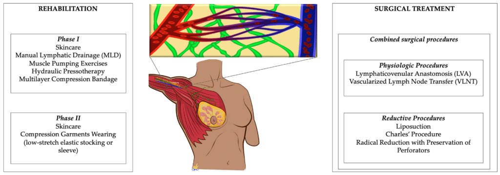Managing Lymphoedema: Strategies and Techniques