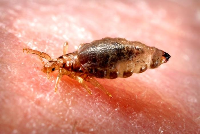 Mitigating the Spread of Louse-borne Typhus