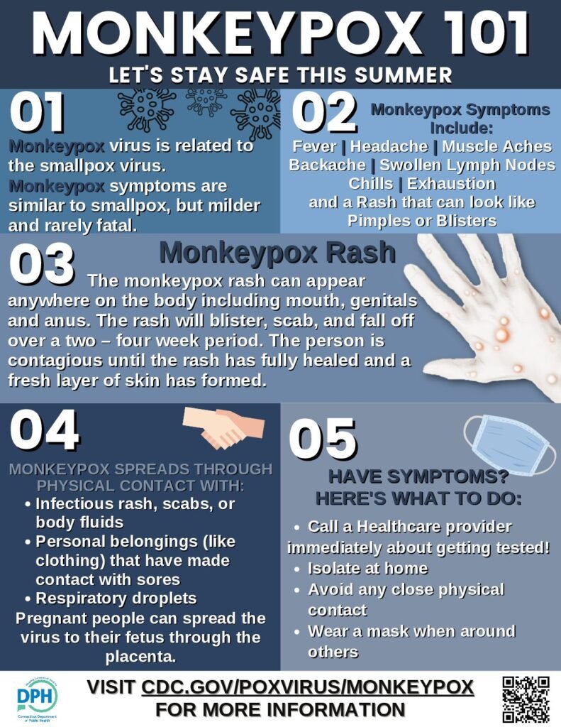 Monkeypox Outbreak: A Closer Look at the Symptoms and Prevention