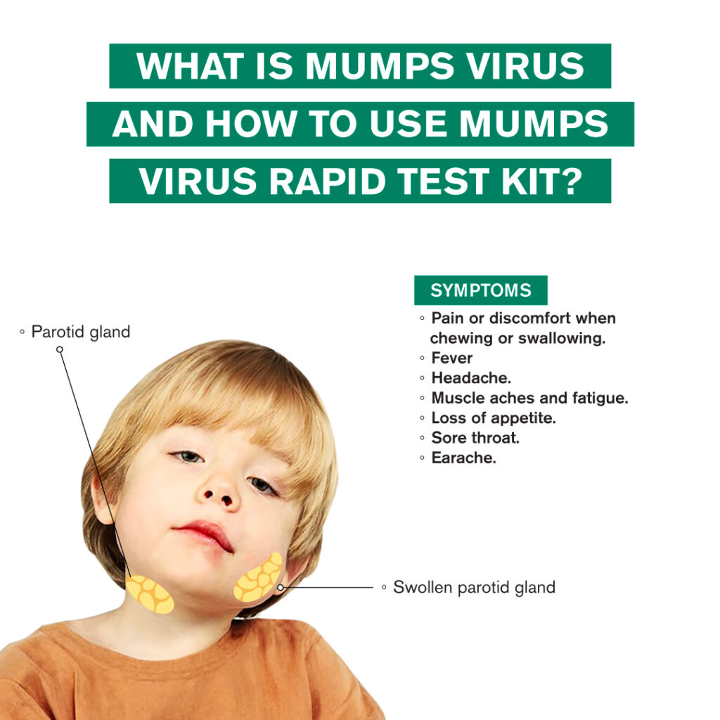 Mumps: A Contagious Viral Infection Explained