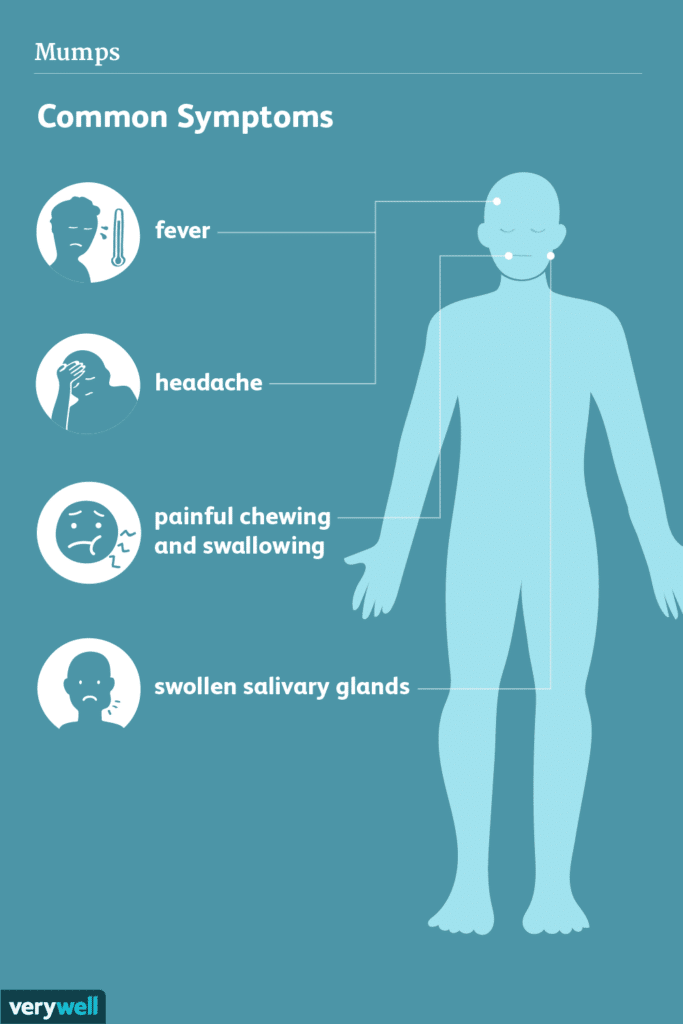 Mumps Complications: What You Need to Know