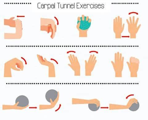 Natural Remedies for Alleviating Carpal Tunnel Syndrome
