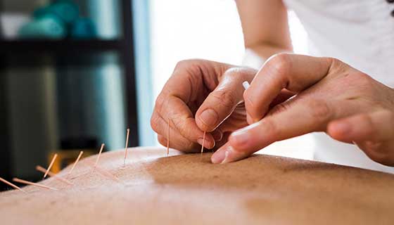 Natural Remedy For Acupuncture