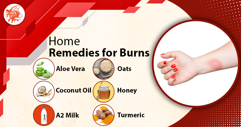 Natural Remedy For Burns Natural Remedy For Burns