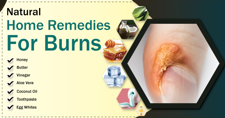 Natural Remedy For Burns Natural Remedy For Burns