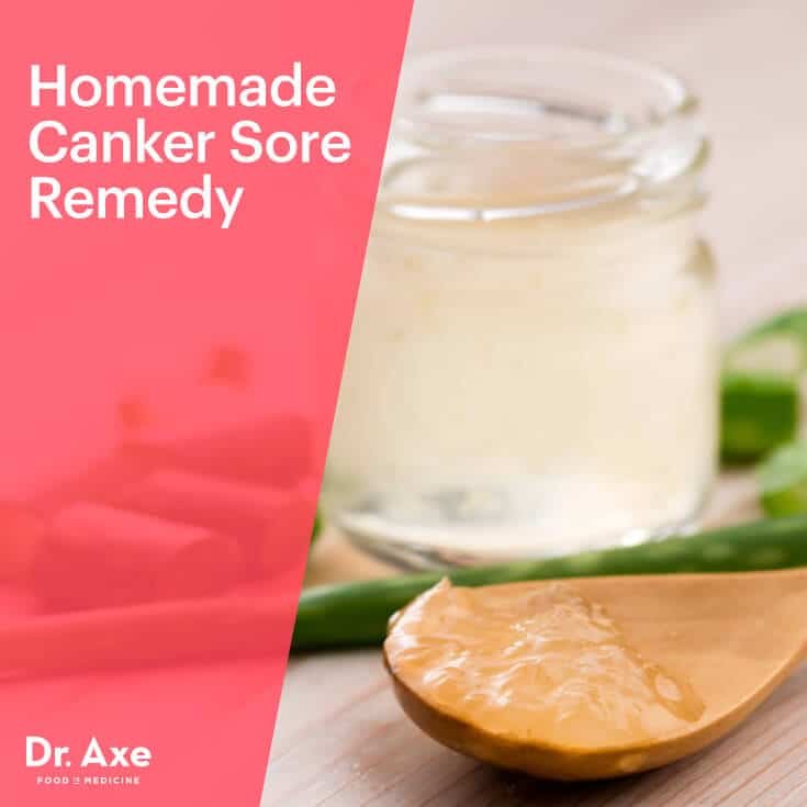 Natural Remedy For Canker Sores