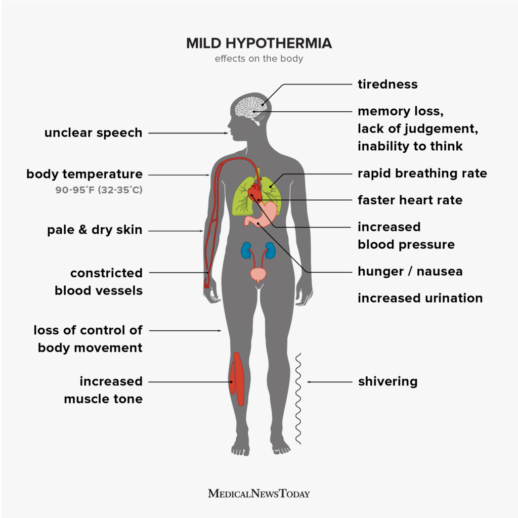 Natural Remedy For Hypothermia