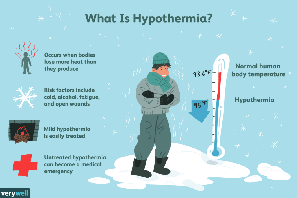 Natural Remedy For Hypothermia