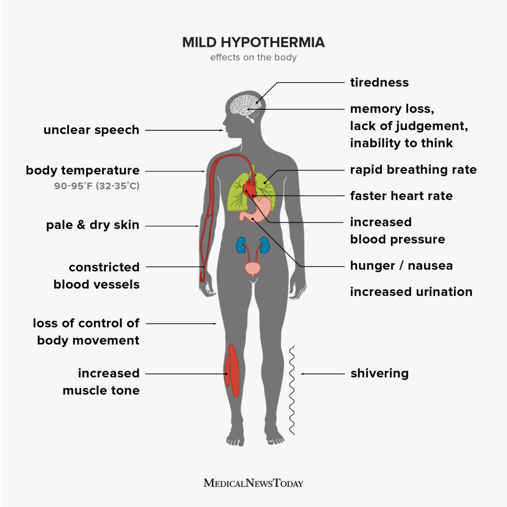 Natural Remedy For Hypothermia