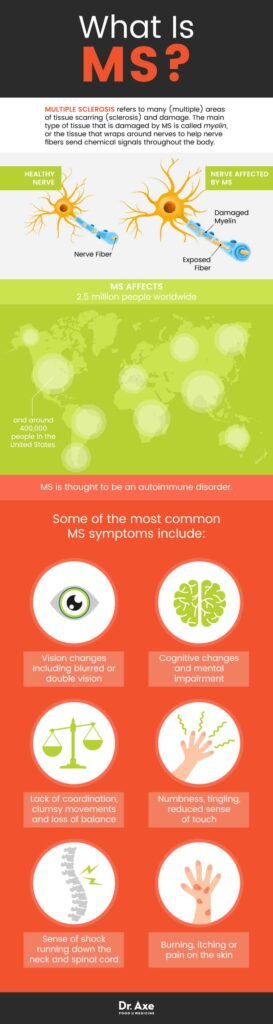 Natural Remedy For Multiple Sclerosis