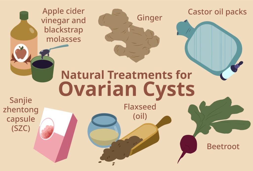 Natural Remedy For Ovarian Cysts
