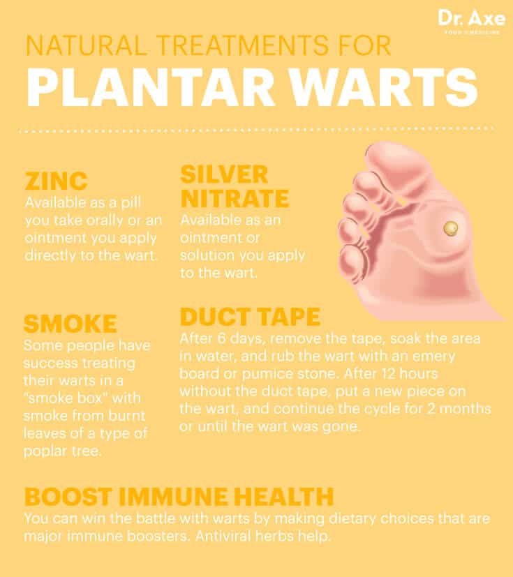 Natural Remedy For Plantar Warts