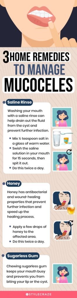 Natural Remedy For Pseudocyst