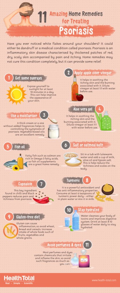 Natural Remedy For Psoriasis
