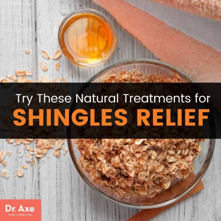 Natural Remedy For Shingles