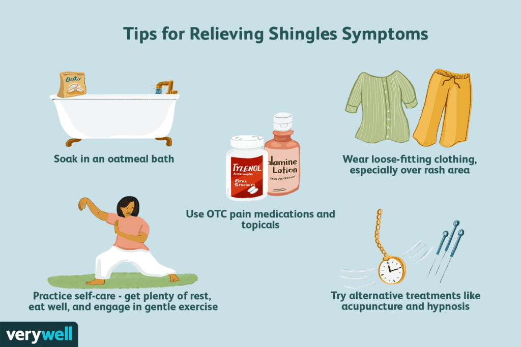 Natural Remedy For Shingles