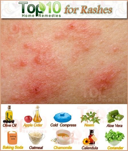 Natural Remedy For Skin Rash