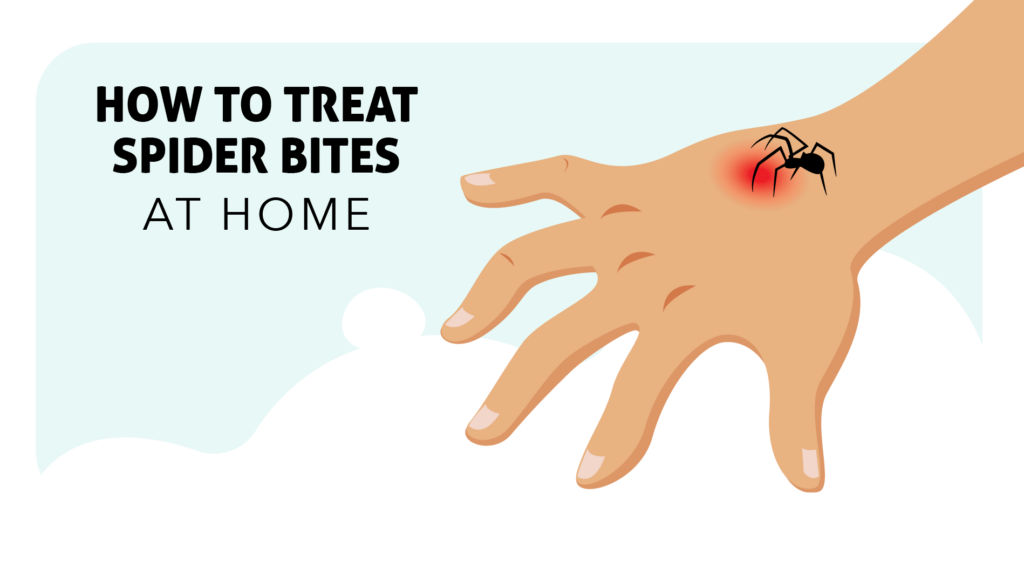 Natural Remedy For Spider Bites