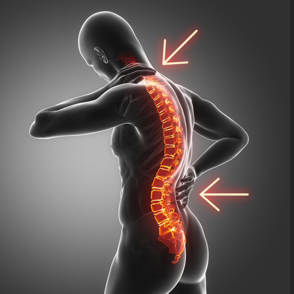 Natural Remedy For Spine Curvature Disorders