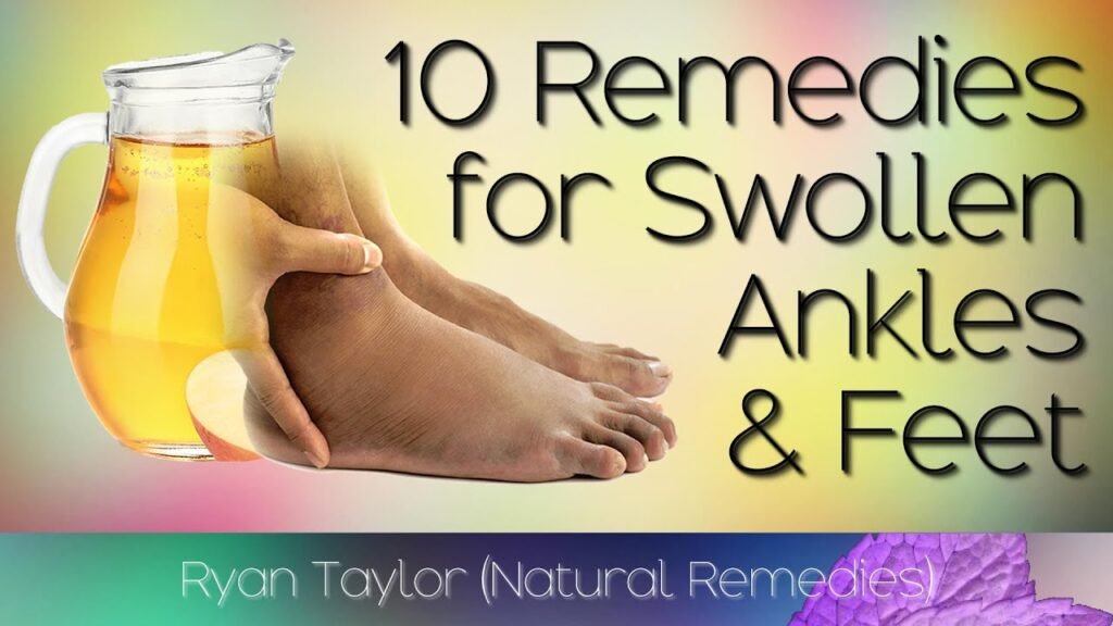 Natural Remedy For Swollen Feet Or Ankles