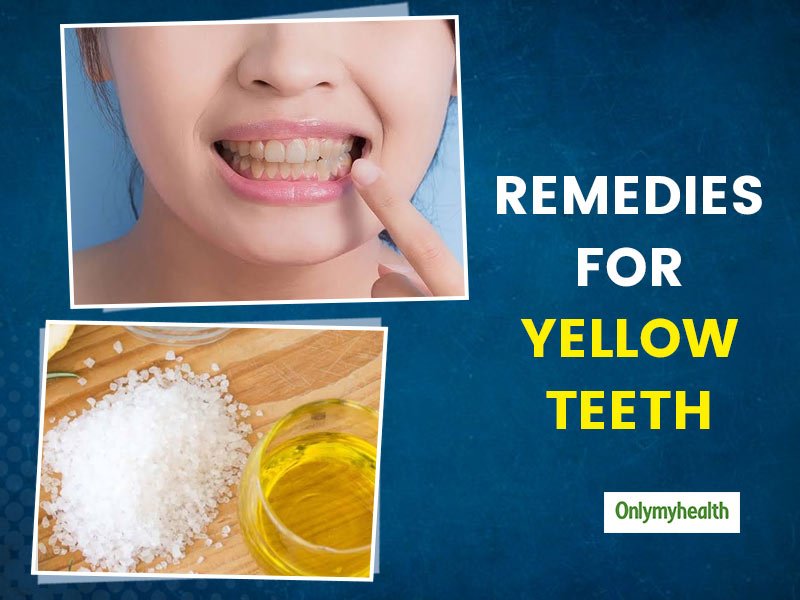 Natural Remedy For Teeth Whitening