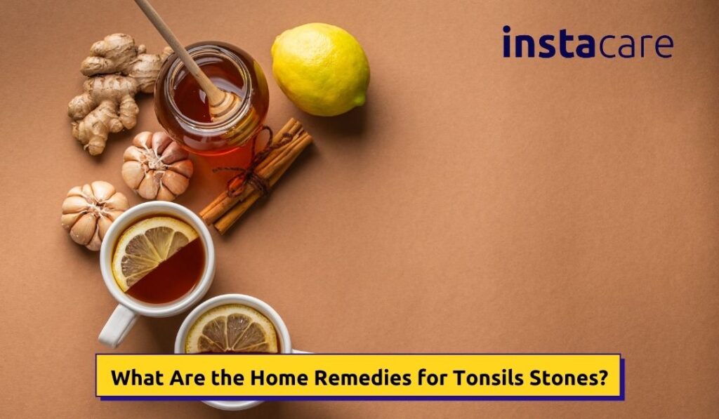 Natural Remedy For Tonsil Stones