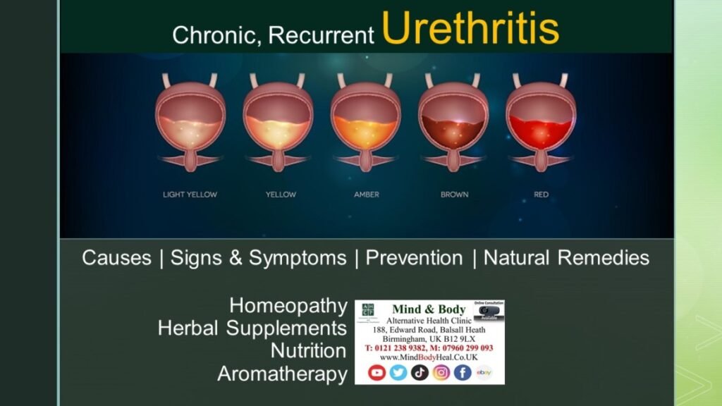 Natural Remedy For Urethritis