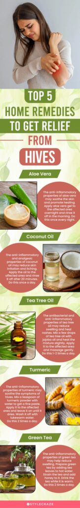 Natural Remedy For Urticaria Natural Remedy For Urticaria