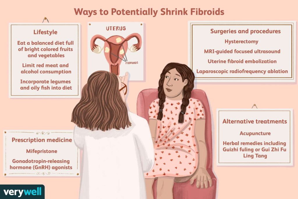 Natural Remedy For Uterine Fibroids Natural Remedy For Uterine Fibroids