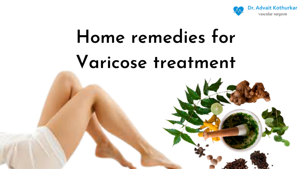 Natural Remedy For Varicose Veins Natural Remedy For Varicose Veins