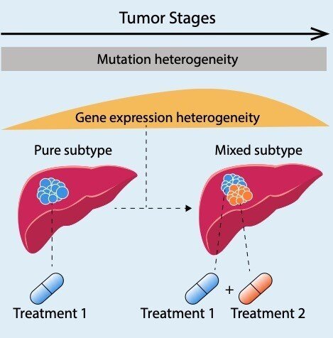 New Advances in Liver Cancer Research